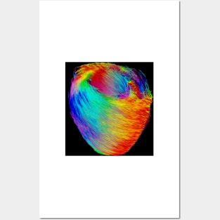 Heart muscle fibres, DTI scan (C021/5126) Posters and Art